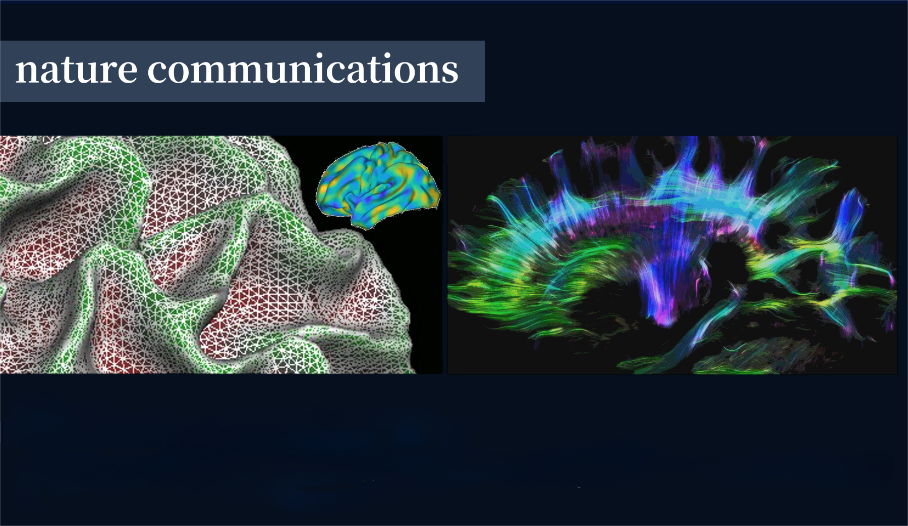 Study Reveals the Secrets of Brain “Folding” and “Wiring”: A Symphony of Gray and White Matter