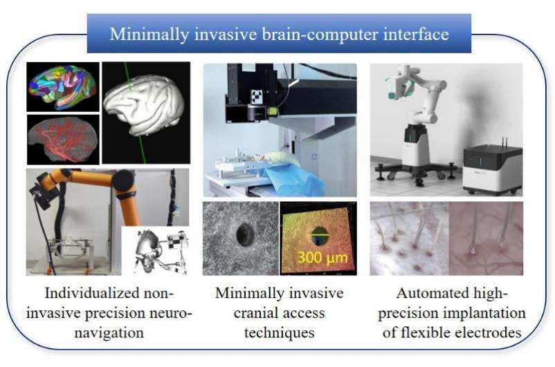 Brain-Computer Interface and Integrated Intelligence